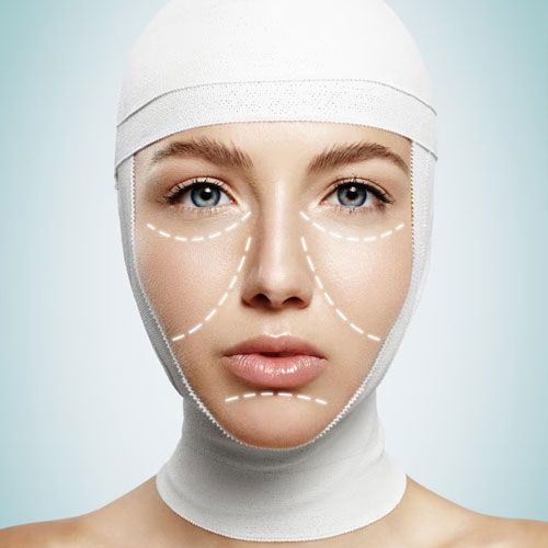 Facial Orthopeadics