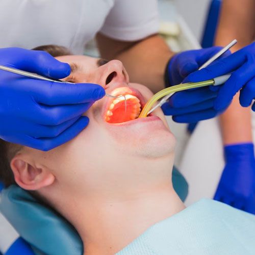 Root canal treatment