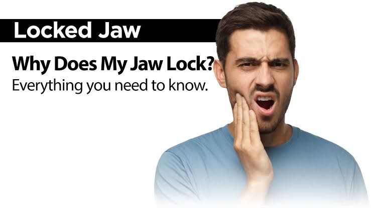 Jaw Locking: What It Means and When to Seek Care